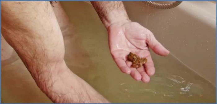 Lady Amy and Lady Atropa Dominate Toilet Slave in Scatqueens-Berlin Exclusive download from ScatHD.com 