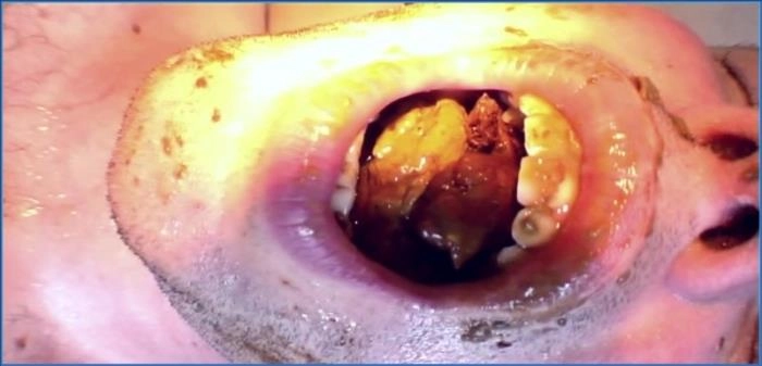 German Femdom Scat Domination with Lady Amy and Lady Atropa in HD