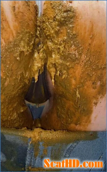 Teen Fisting Mayhem with Sexandcandy18 in Extreme Jean Accident