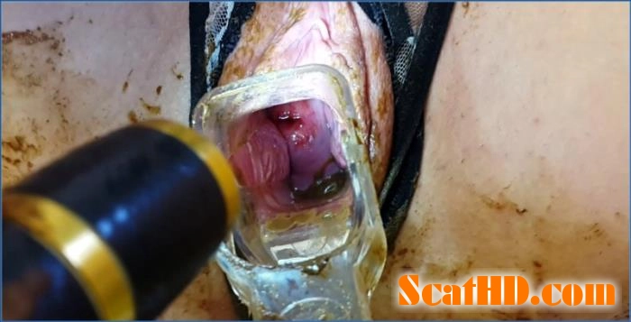 Intense Solo Speculum Play During Menstruation with Anna Coprofield FullHD download from ScatHD.com 